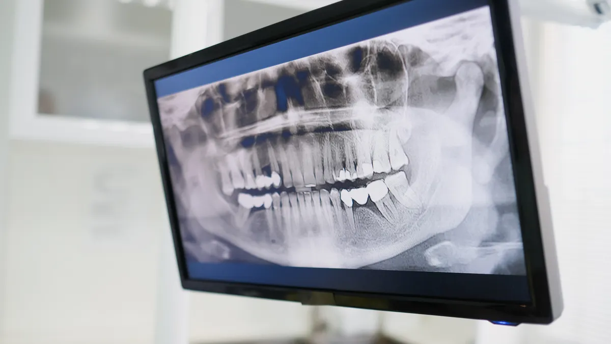 Windows 10 in GP practices: a clinic monitor showing a dental X-ray in a treatment room